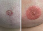 Mellbimbó (areola) tetoválás, Sminktetoválás Budapest