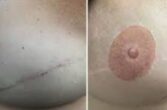 Mellbimbó (areola) tetoválás, Sminktetoválás Budapest
