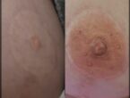 Mellbimbó (areola) tetoválás, Sminktetoválás Budapest