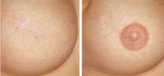 Mellbimbó (areola) tetoválás, Sminktetoválás Budapest